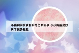 小孩胸前皮肤有癣是怎么回事 小孩胸前皮肤长了很多粒粒