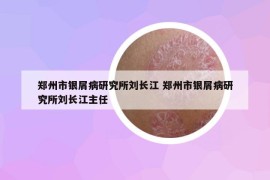 郑州市银屑病研究所刘长江 郑州市银屑病研究所刘长江主任