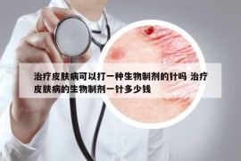 治疗皮肤病可以打一种生物制剂的针吗 治疗皮肤病的生物制剂一针多少钱