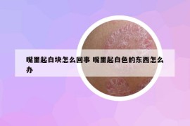 嘴里起白块怎么回事 嘴里起白色的东西怎么办