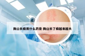 胸口长癣用什么药膏 胸口长了癣越来越大