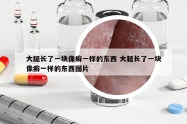 大腿长了一块像癣一样的东西 大腿长了一块像癣一样的东西图片