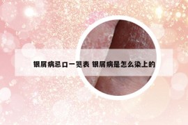 银屑病忌口一览表 银屑病是怎么染上的