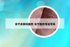 会宁皮肤科医院 会宁医院电话号码