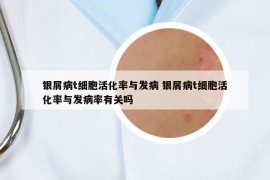 银屑病t细胞活化率与发病 银屑病t细胞活化率与发病率有关吗