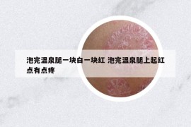 泡完温泉腿一块白一块红 泡完温泉腿上起红点有点疼