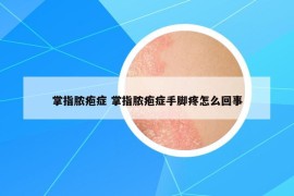 掌指脓疱症 掌指脓疱症手脚疼怎么回事