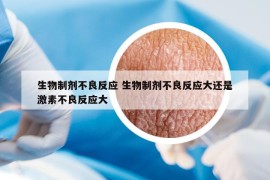 生物制剂不良反应 生物制剂不良反应大还是激素不良反应大