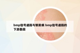 bmp信号通路与银屑病 bmp信号通路的下游基因