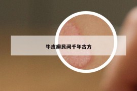 牛皮癣民间千年古方