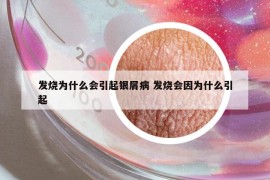 发烧为什么会引起银屑病 发烧会因为什么引起