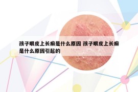 孩子眼皮上长癣是什么原因 孩子眼皮上长癣是什么原因引起的