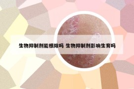 生物抑制剂能根除吗 生物抑制剂影响生育吗