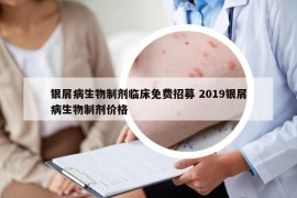 银屑病生物制剂临床免费招募 2019银屑病生物制剂价格