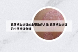 银屑病血热证的主要治疗方法 银屑病血热证的中医辩证分析