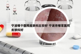 宁波哪个医院皮肤科比较好 宁波市哪家医院皮肤科好