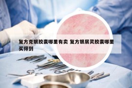 复方克银胶囊哪里有卖 复方银屑灵胶囊哪里买得到