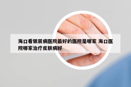 海口看银屑病医院最好的医院是哪家 海口医院哪家治疗皮肤病好