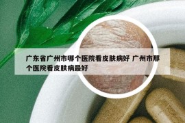 广东省广州市哪个医院看皮肤病好 广州市那个医院看皮肤病最好