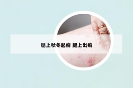 腿上秋冬起癣 腿上出癣