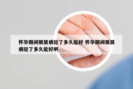 怀孕期间银屑病犯了多久能好 怀孕期间银屑病犯了多久能好啊