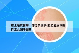 脸上起皮像癣一样怎么回事 脸上起皮像癣一样怎么回事图片