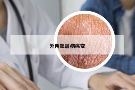 外阴银屑病癌变