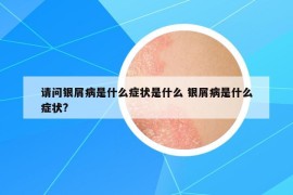 请问银屑病是什么症状是什么 银屑病是什么症状?