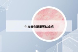 牛皮癣你那里可以吃吗