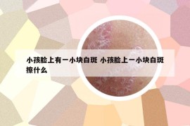 小孩脸上有一小块白斑 小孩脸上一小块白斑擦什么