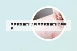 生物制剂治疗什么病 生物制剂治疗什么病的药