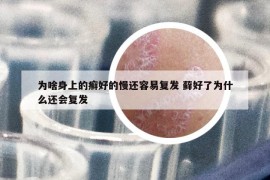 为啥身上的癣好的慢还容易复发 藓好了为什么还会复发