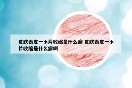 皮肤表皮一小片收缩是什么癣 皮肤表皮一小片收缩是什么癣啊