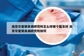 南京华夏银屑病研究所怎么样哪个医生好 南京华夏银屑病研究所如何