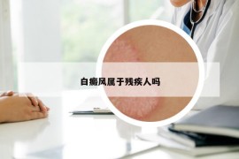 白癜风属于残疾人吗