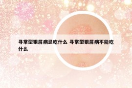 寻常型银屑病忌吃什么 寻常型银屑病不能吃什么