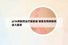 pi3k抑制剂治疗银屑病 银屑生物抑制剂进入医保