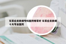 石家庄皮肤病专科医院哪家好 石家庄皮肤病十大专业医院