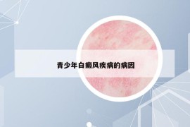 青少年白癜风疾病的病因