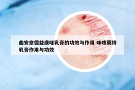 曲安奈德益康唑乳膏的功效与作用 咪喹莫特乳膏作用与功效