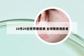 10月29日世界银屑病 全球银屑病患者