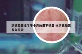 消银胶囊吃了半个月效果不明显 吃消银胶囊多久见效