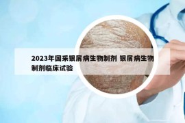 2023年国采银屑病生物制剂 银屑病生物制剂临床试验