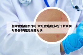 脂掌脓疱病忌口吗 掌趾脓疱病多吃什么食物对身体好提高免疫力快