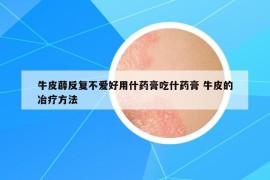 牛皮薜反复不爱好用什药膏吃什药膏 牛皮的冶疗方法