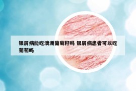 银屑病能吃澳洲葡萄籽吗 银屑病患者可以吃葡萄吗