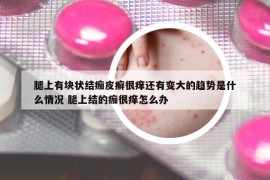 腿上有块状结痂皮癣很痒还有变大的趋势是什么情况 腿上结的痂很痒怎么办