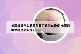 毛囊炎是什么原因引起的该怎么治疗 毛囊炎的症状是怎么样的