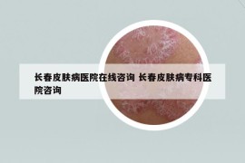 长春皮肤病医院在线咨询 长春皮肤病专科医院咨询