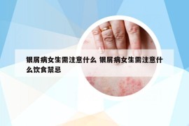 银屑病女生需注意什么 银屑病女生需注意什么饮食禁忌